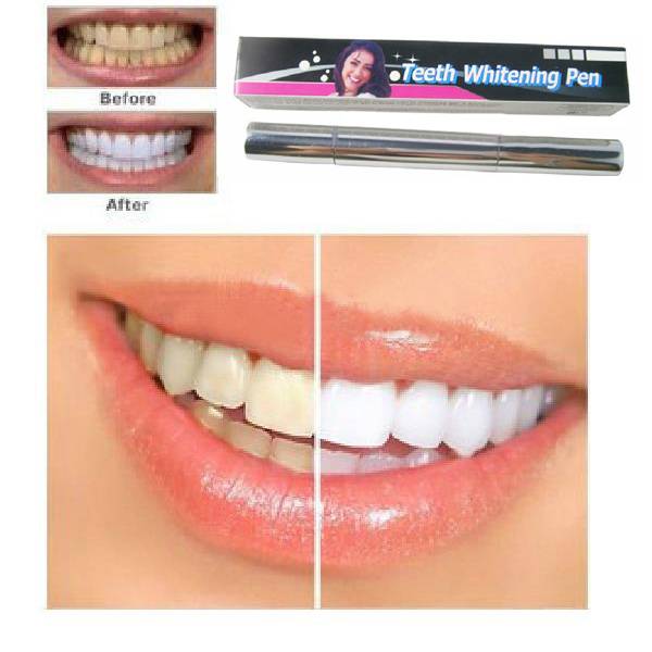 Js Teeth Whitening Pen js kopen in de aanbieding Js Teeth Whitening Pen js kopen in de aanbieding