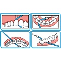 iDontix X-Floss Lite | 30 stuks