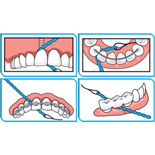 iDontix X-Floss Lite | 30 stuks