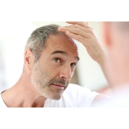 Hair loss man
