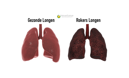 Teer en nicotine in sigaretten: schadelijke effecten op de gezondheid en hoe te stoppen met roken