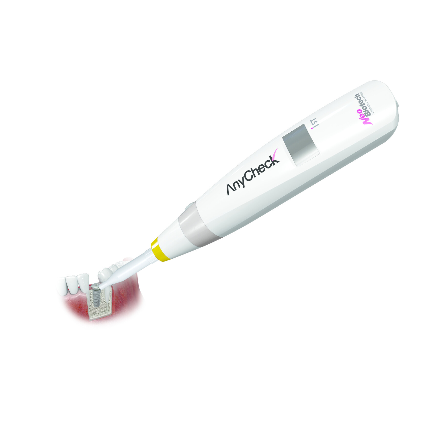 NeoBiotech AnyCheck
