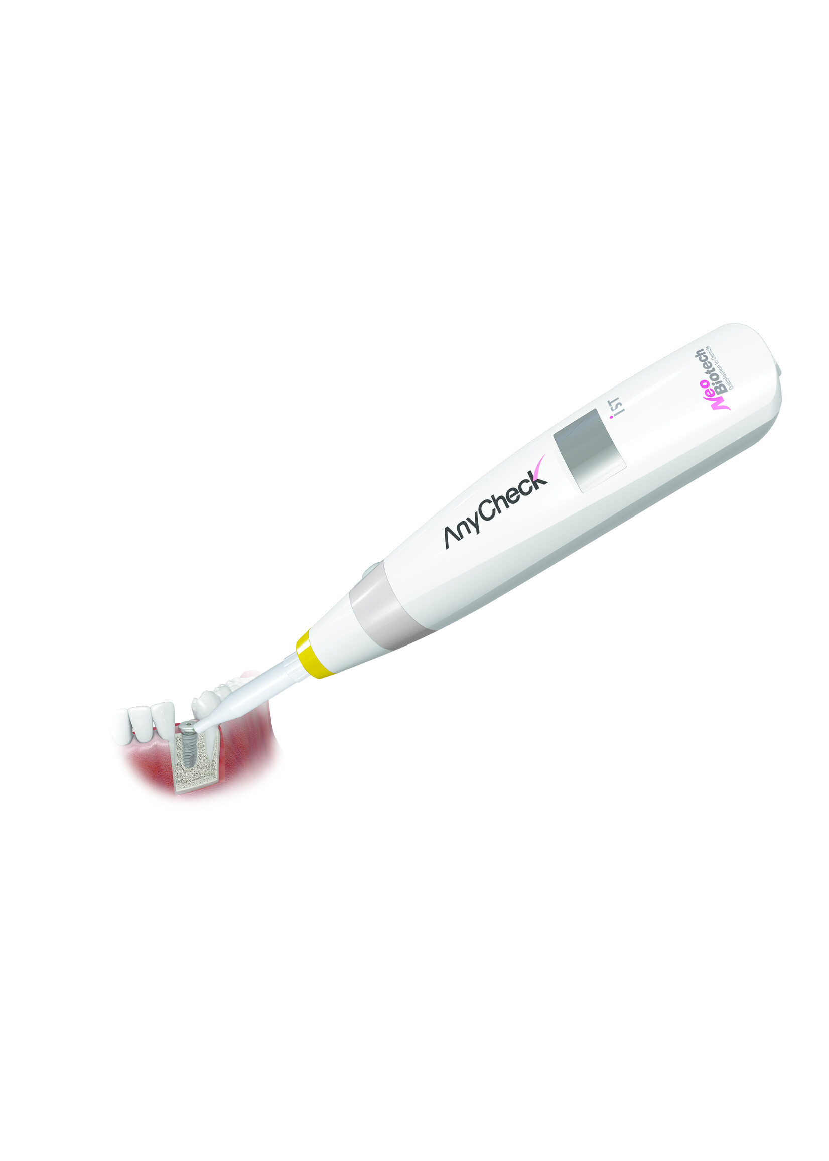 NeoBiotech AnyCheck