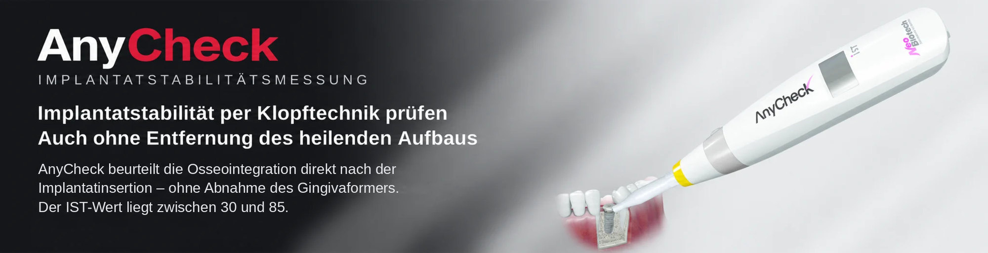 NeoBiotech AnyCheck Implantatstabilitätsmessgerät