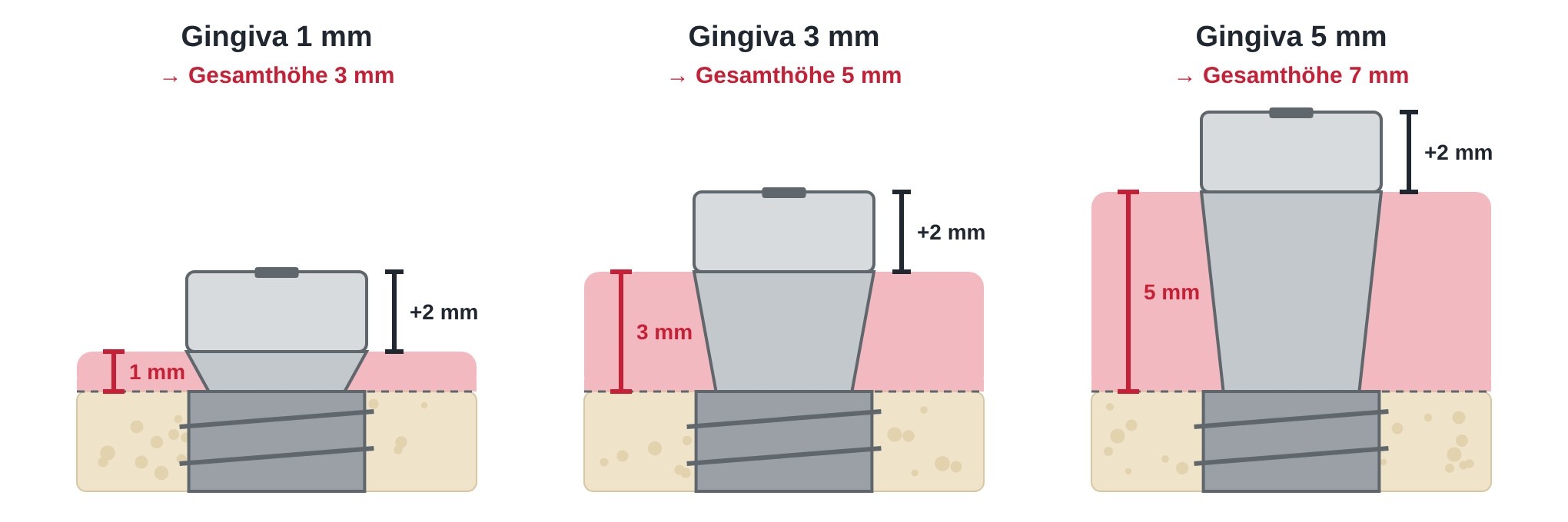 Gingivaformer: Gingivahöhe 1, 3 und 5 mm ergibt Gesamthöhe 3, 5 und 7 mm