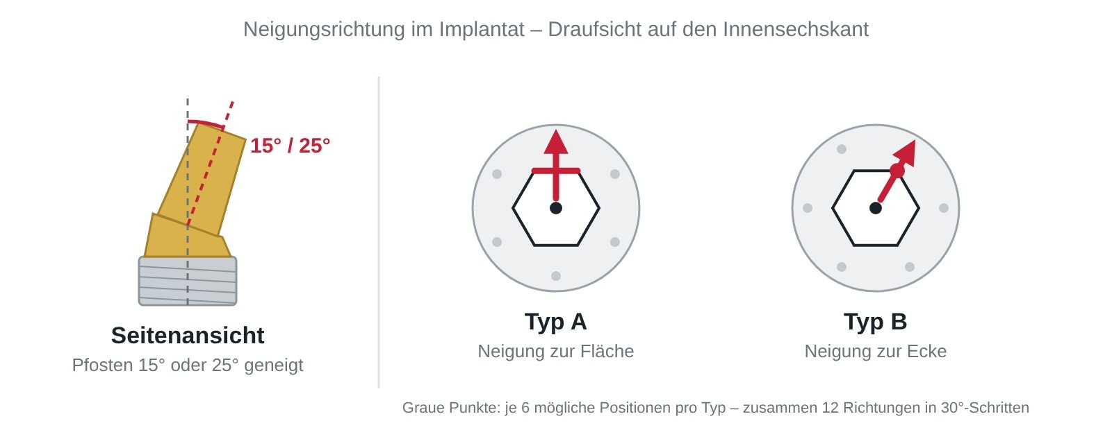 Abgewinkeltes Abutment: Seitenansicht 15° oder 25° sowie Typ A Neigung zur Fläche und Typ B Neigung zur Ecke des Innensechskants