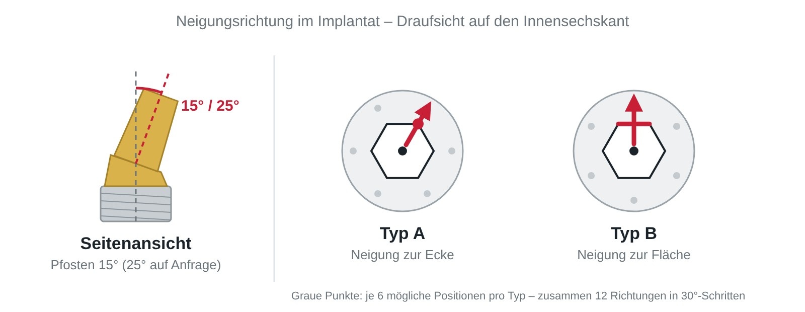 Neobiotech angled abutment: side view 15°, type A angled towards a corner and type B towards a flat of the internal hex