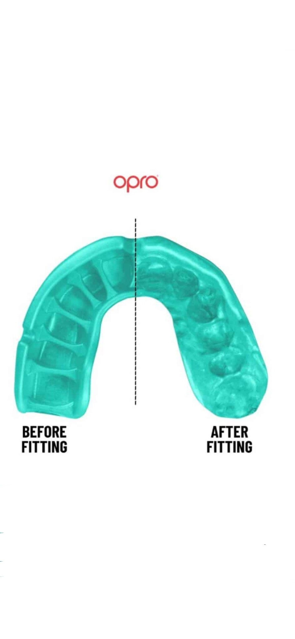 OPRO Shield Platinum gebitsbeschermer