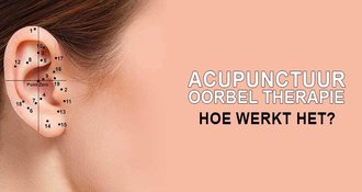 Acupunctuur Oorbel Therapie