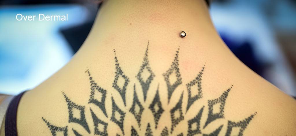 Dermal Piercings