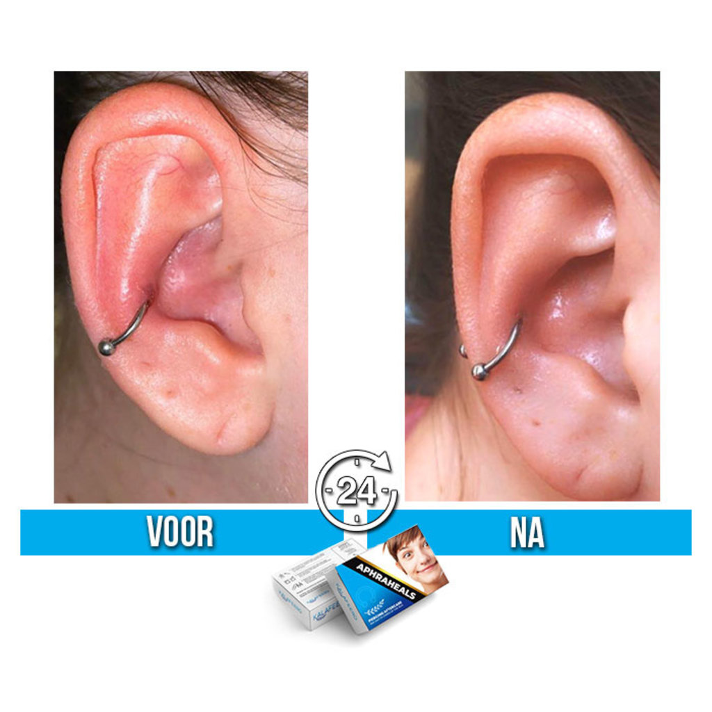 Aphraheals Piercing Zeezout Pleister Tegen Ontsteking Piercings Works
