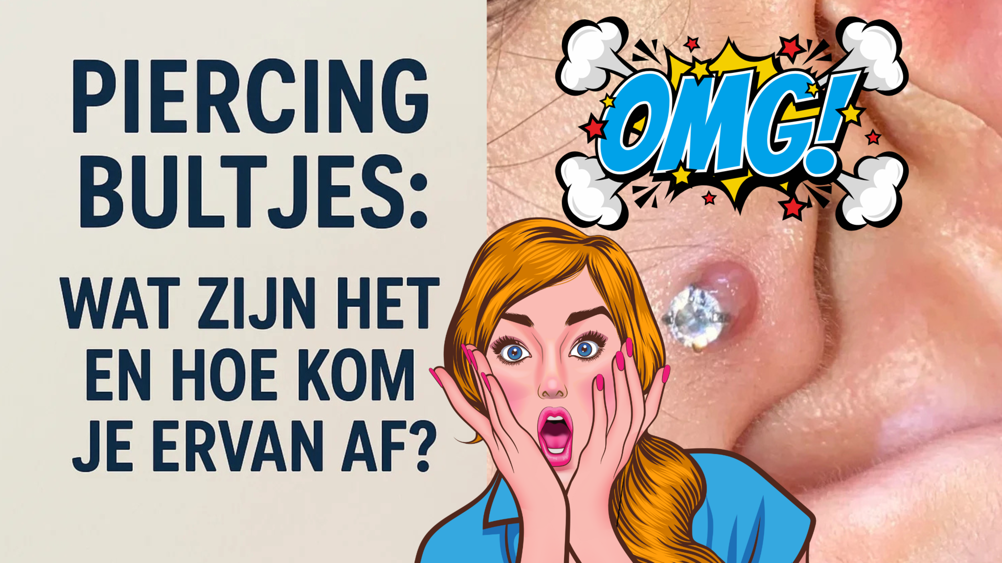 Piercing Bultjes: Wat Zijn Het en Hoe Kom Je Ervan Af?