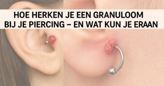 Hoe herken je een granuloom bij je piercing – en wat kun je eraan doen?