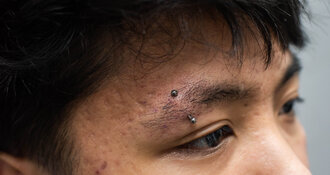 Waarom dit een van de meest begrepen maar minst begrepen piercings is