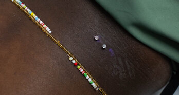 Surface Piercing Op De Rug – Esthetiek, Anatomie En Risico’s