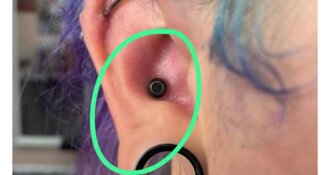 Gestretchte conch piercing Waarom veilig stretchen beter is dan een dermal punch