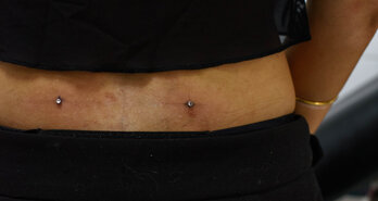 Wat is een dermal piercing?