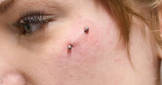 What is a dermal piercing?