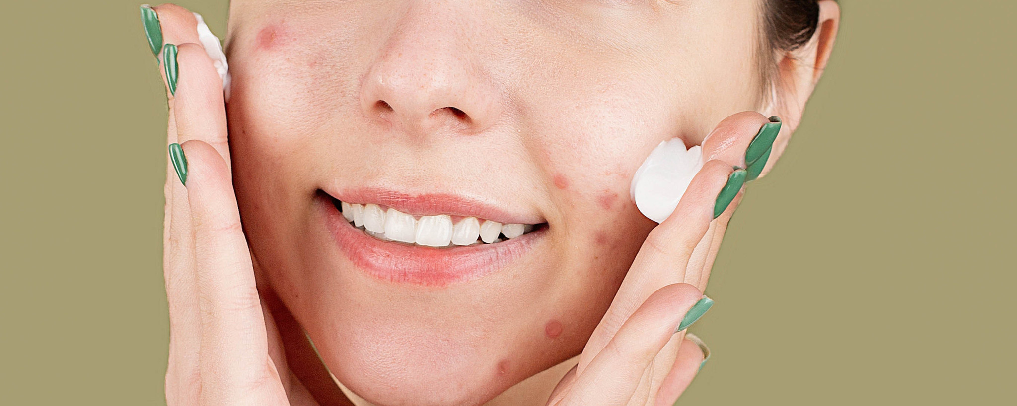 Pimples after using a new care product? A good sign!