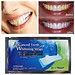 Whitening Strips 14 Stück