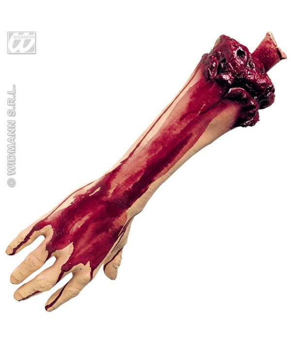 Afgehakte arm
