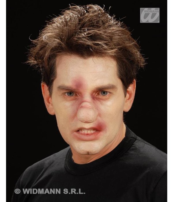 Gebroken neus professioneel