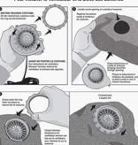 Opblaasbaar Eenhoorn Kostuum