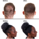 Nanogen Nanogen Keratin Hair Fibers - 15g Nanogen Nanogen Keratin Hair Fibers - 15g