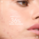 Vichy Vichy Normaderm PROBIO-BHA Serum Anti-Onzuiverheden - 30ml Vichy Vichy Normaderm PROBIO-BHA Serum Anti-Onzuiverheden - 30ml