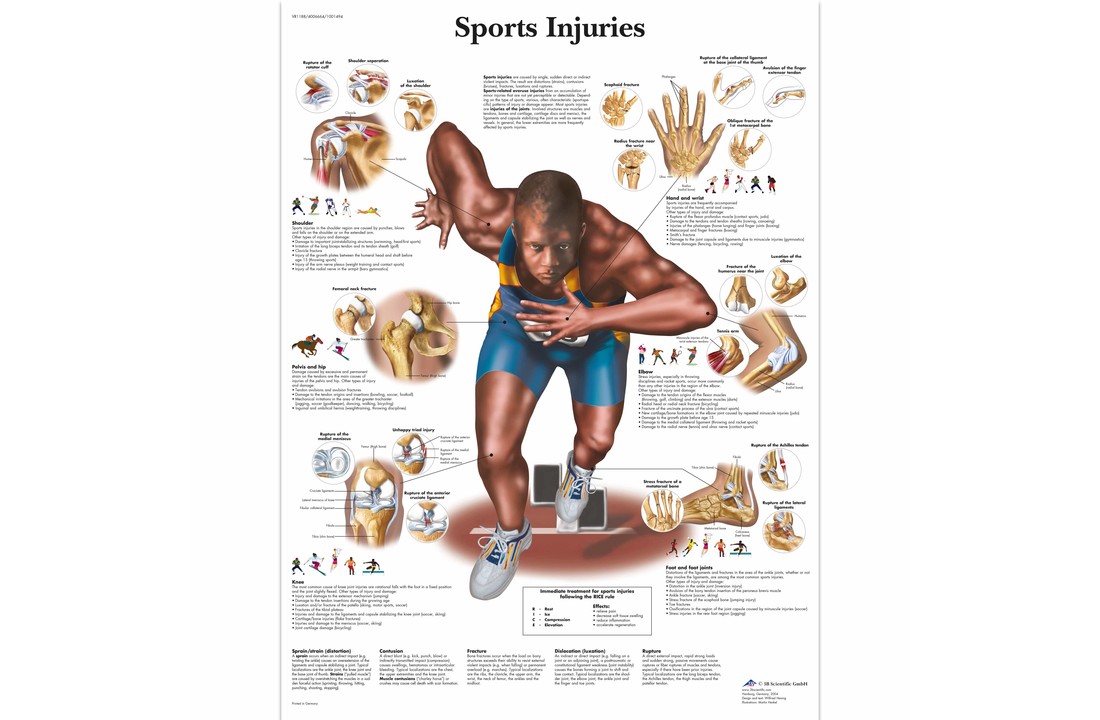 Poster sport Injuries Chart gelamineerd