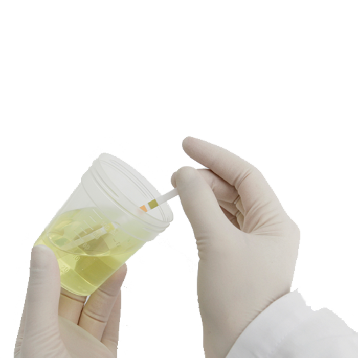 Test urinaire : Roche Combur 7 – bandelettes de test Roche - farla medical  - Test urinaire Roche