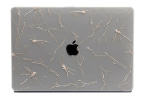 Lunso MacBook Pro 15 inch (2016-2020) cover hoes - case - Dragonfly White