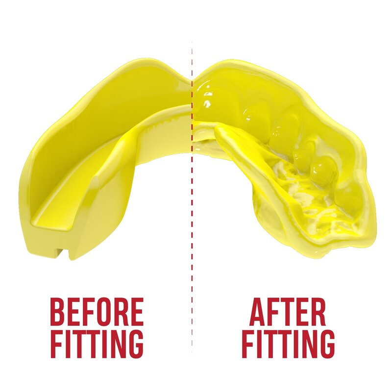 SAFEJAWZ SAFEJAWZ® Intro Series Mouthguard Yellow - Kids