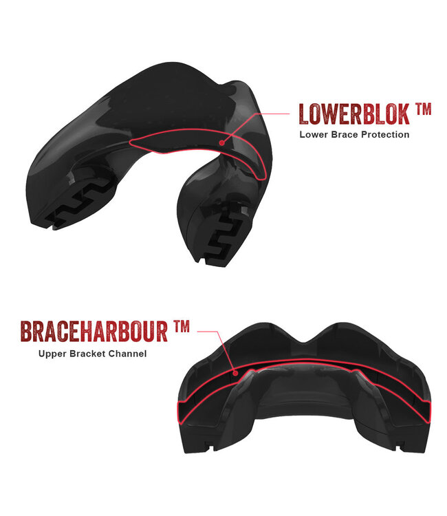 SAFEJAWZ® Ortho Series Gebitsbeschermer Beugels Zwart