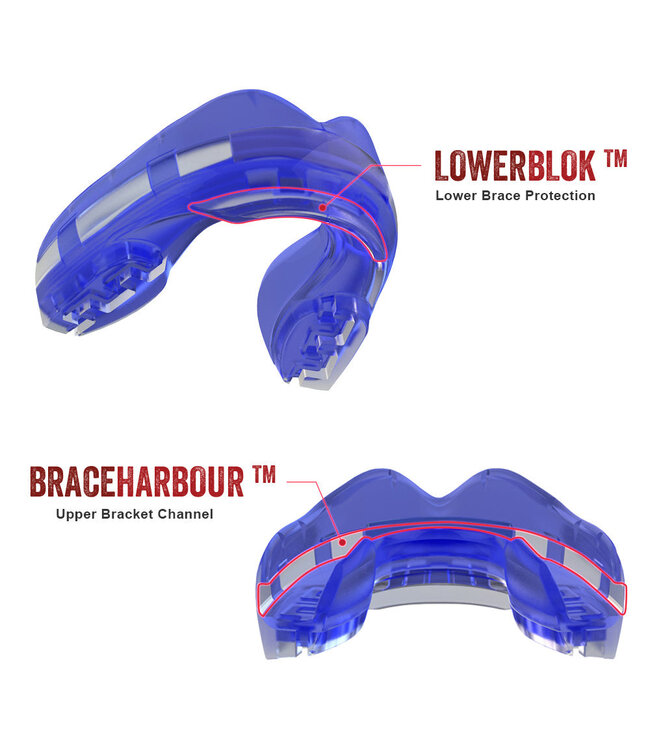 SAFEJAWZ SAFEJAWZ® Ortho Series Gebitsbeschermer Beugels Ice Blue