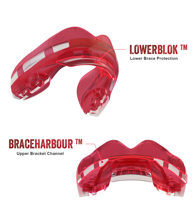 SAFEJAWZ® Ortho Series Mundschutz Zahnspangen Ice Pink