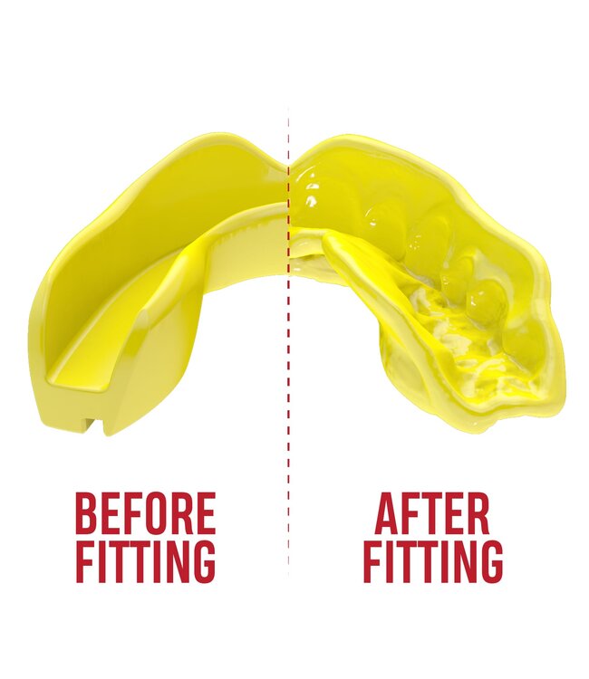 SAFEJAWZ® Intro Series Mouthguard Yellow