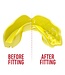 SAFEJAWZ® Intro Series Mouthguard Yellow