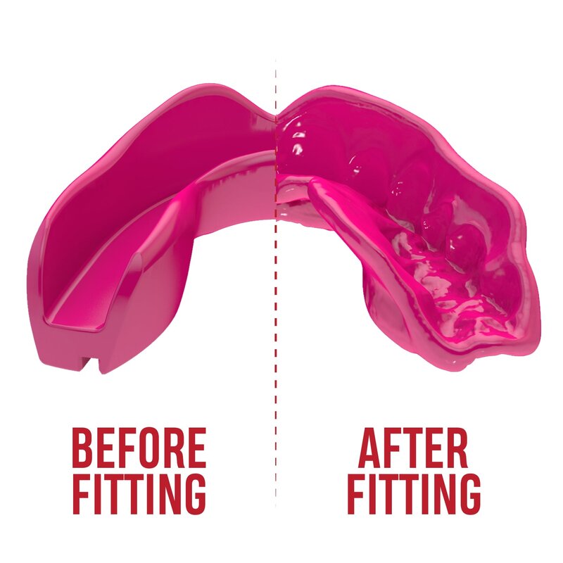 SAFEJAWZ SAFEJAWZ® Intro Series Mond- Gebitsbeschermer Roze - Kids