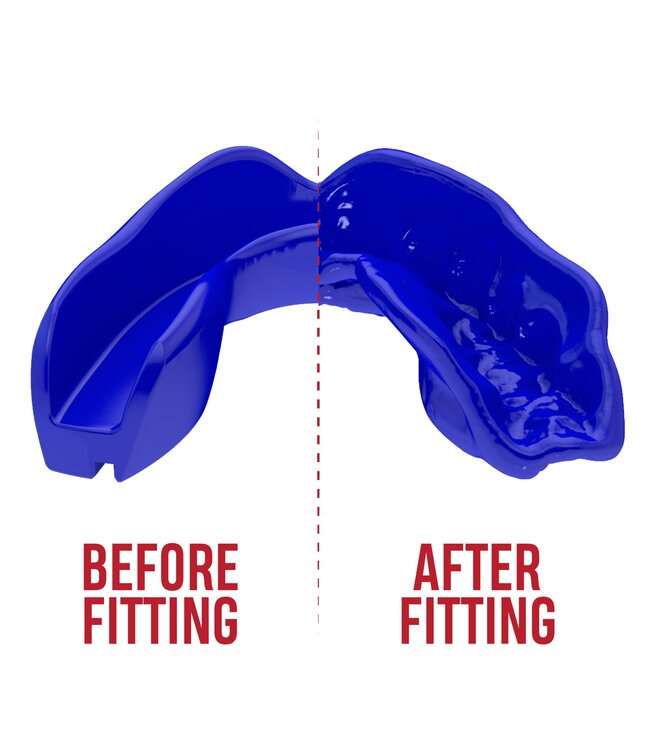 SAFEJAWZ® Intro Series Gebitsbeschermer Blauw - Kids