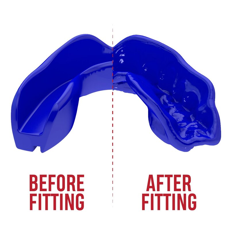 SAFEJAWZ SAFEJAWZ® Intro Series Mouthguard Blue - Kids