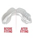 SAFEJAWZ® Intro Series Mond- Gebitsbeschermer Wit