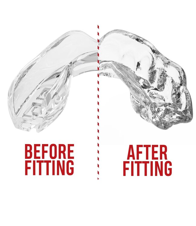 SAFEJAWZ® Intro Series Mouthguard Transparent