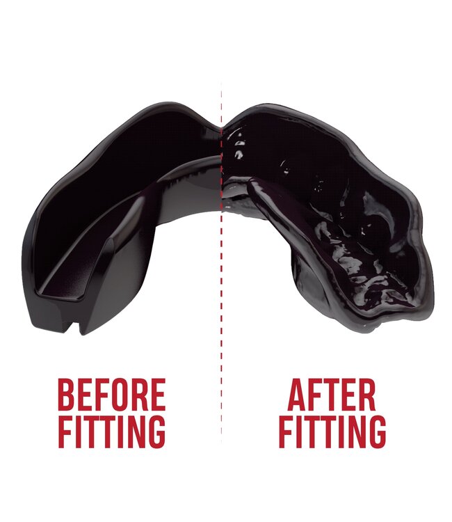 SAFEJAWZ® Intro Series Mundschutz Schwarz Kinder