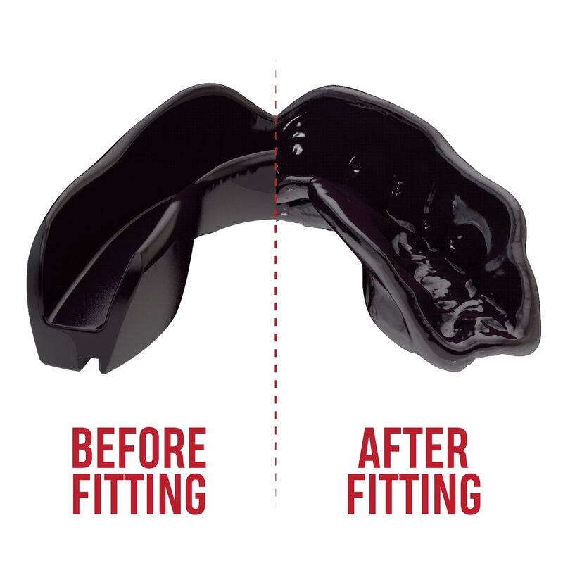SAFEJAWZ SAFEJAWZ® Intro Series Mouthguard Black Kids