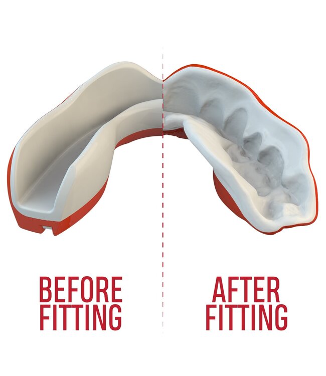 SAFEJAWZ® Extro Series Mouthguard Viper