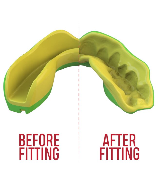 SAFEJAWZ® Extro Series Gebitsbeschermer Ogre