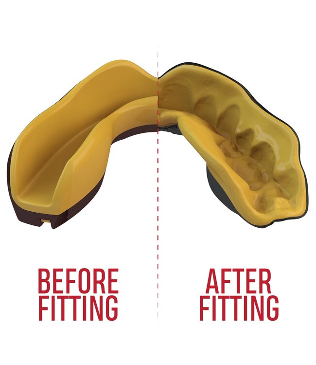 SAFEJAWZ® Extro Series Mouthguard Goldie - Kids