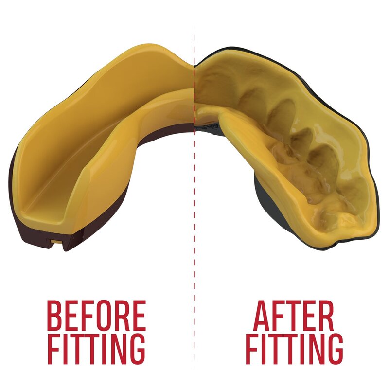 SAFEJAWZ SAFEJAWZ® Extro Series Mouthguard Goldie