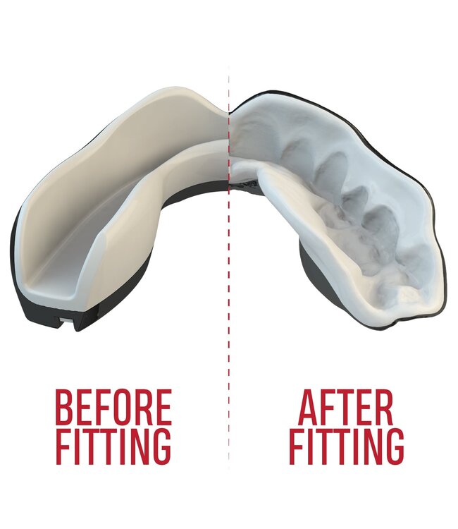 SAFEJAWZ SAFEJAWZ® Extro Series Fangz Gebitsbeschermer Dracula Zwart Wit - Kids